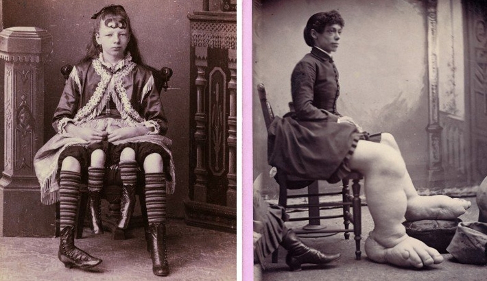 Charles Eisenmann Photographs “Freaks” In The 1870's
