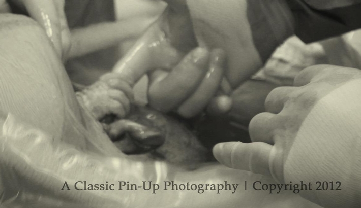 Photo of Baby Grabbing Doctor's Finger During C-Section Goes Viral