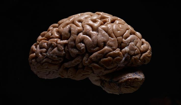 Photographing A Collection Of Human Brains
